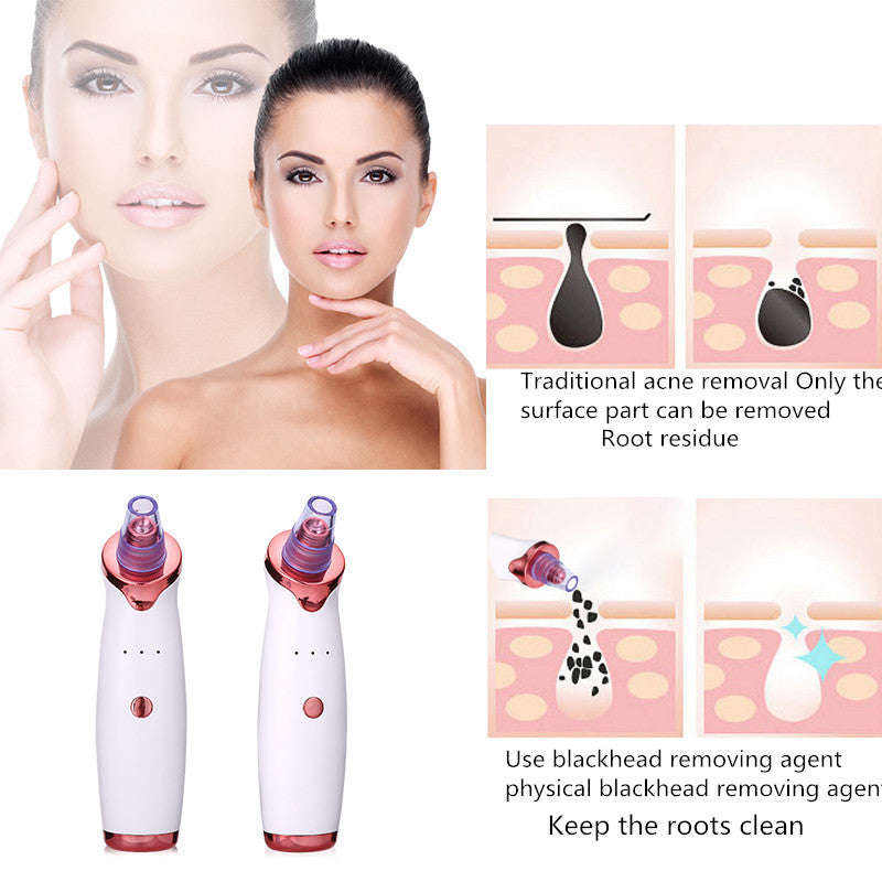 Acne Vacuum Suction